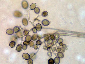 Cucurbit downy mildew sporangia